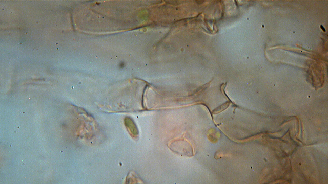 Botryobasidium isabellinum... un 